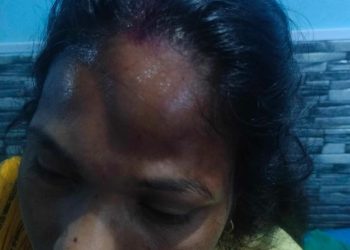 गोलबजारमा एक महिलालाई  कुटपिट गरे