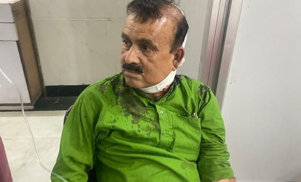 महेन्द्र यादवको राष्ट्रिय ट्रमा सेन्टरमा उपचार