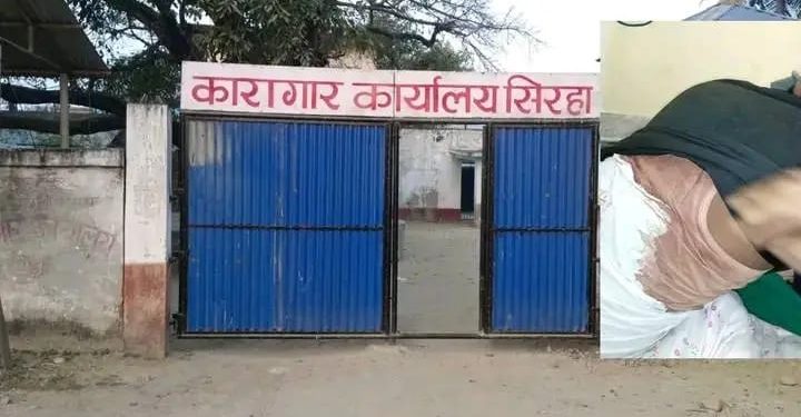 कारागारमा एक कैदीबन्दी उपर मरनासन्न कुटपिट